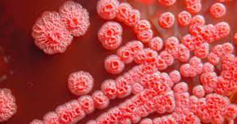 Vi khuẩn ăn thịt người là gì ? Cách phòng tránh bệnh Whitmore bạn cần biết