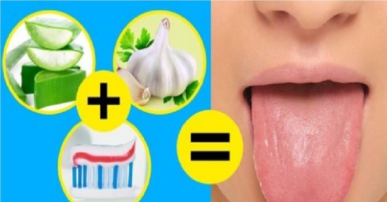 Chẳng cần dùng kem đánh răng ap24 - đây là những cách giúp bạn có hàm răng trắng, lưỡi sạch và hơi thở thơm mát