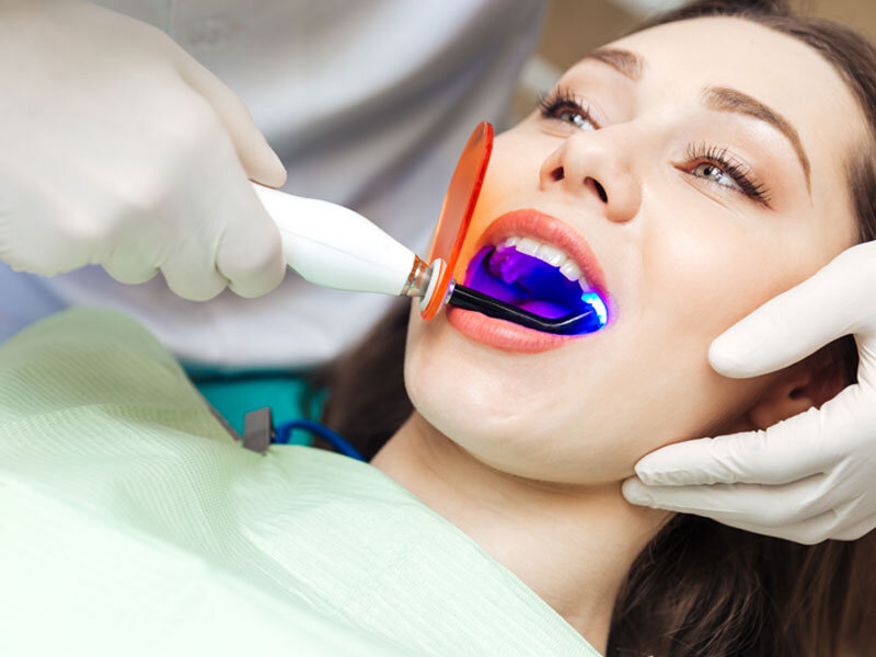 Tác hại của tẩy trắng răng không đúng cách như thế nào?