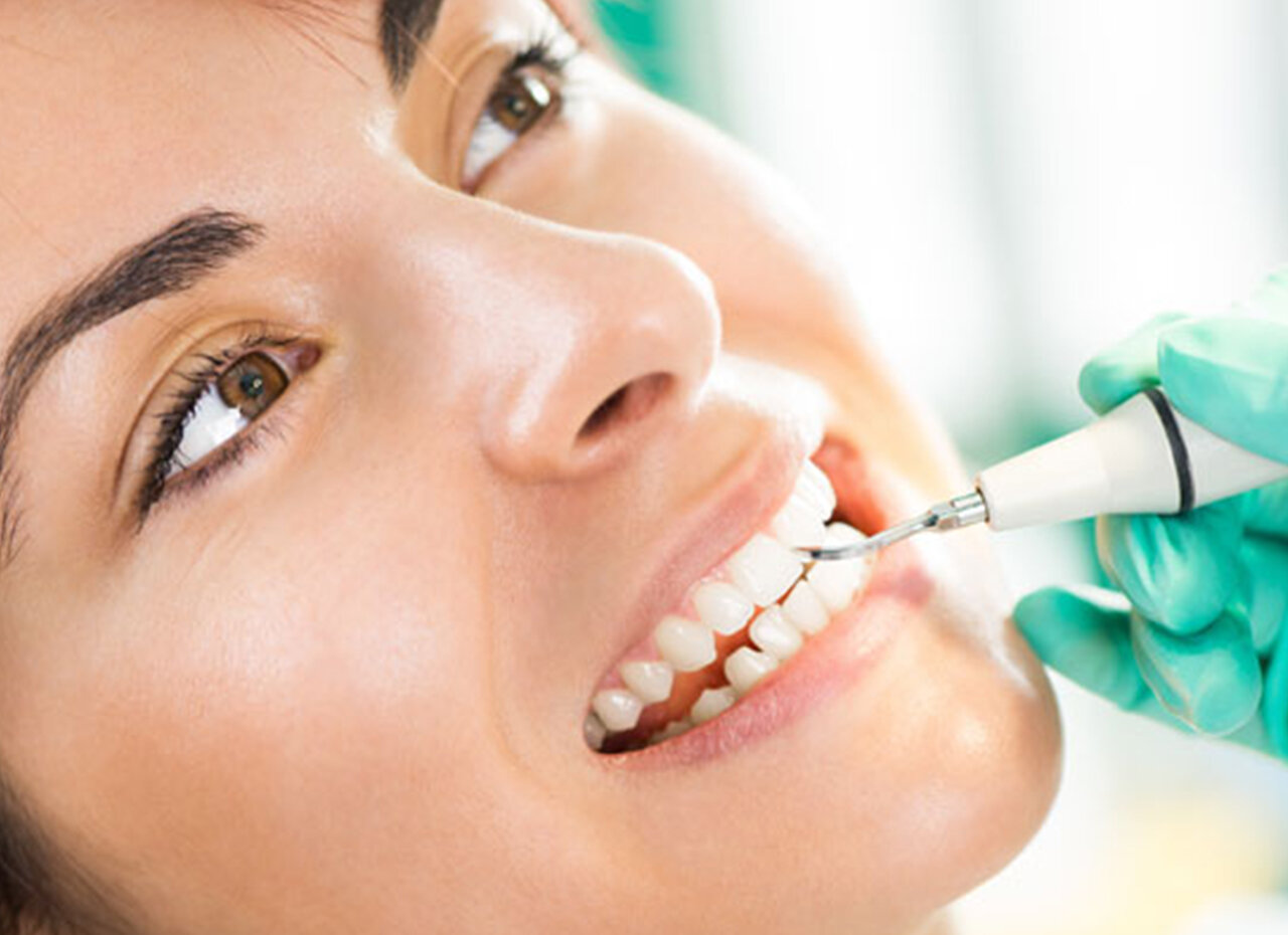 Bọc răng sứ Zirconia có tốt không, gây ra những khó chịu gì 