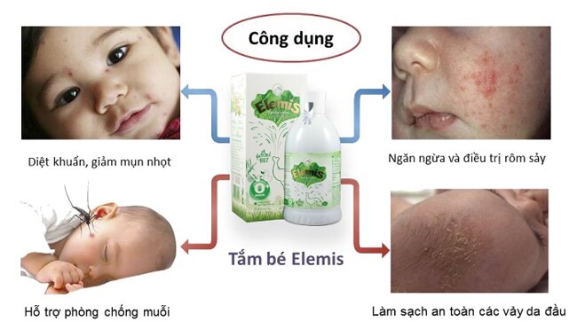 sữa tắm Elemis trị rôm sảy