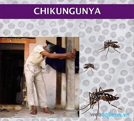 Sốt chikungunya gây đau khớp nặng kéo dài trong nhiều tuần (nguồn: internet)