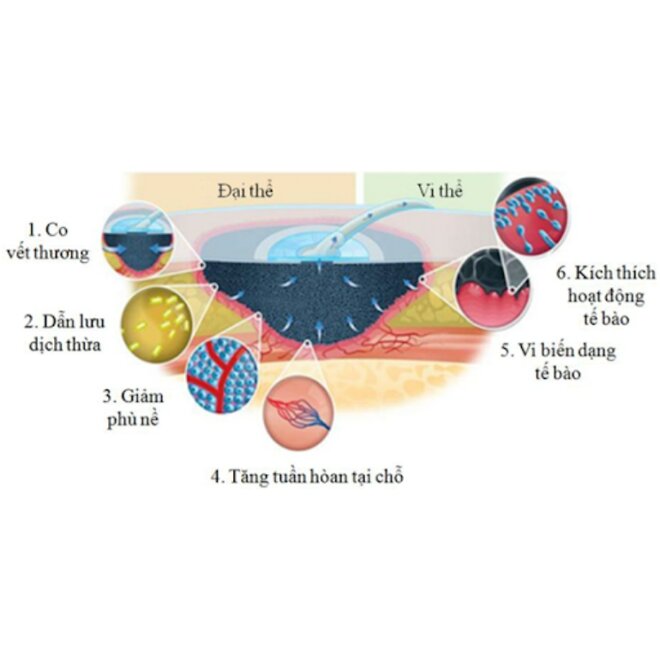 Công dụng của máy hút dịch điều trị vết thương