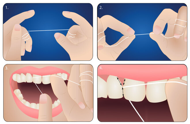 Cách sử dụng chỉ nha khoa đúng nhất 