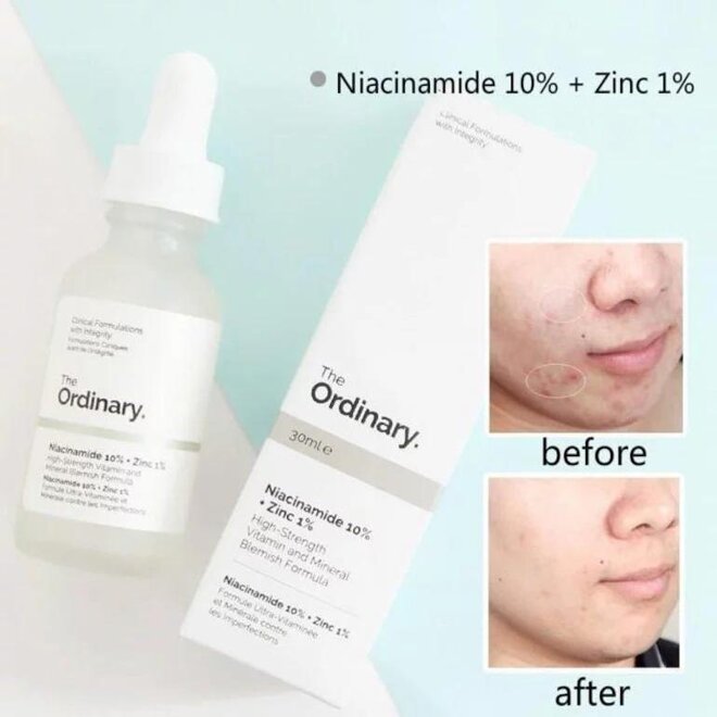 The Ordinary Niacinamide 10% Zinc 1