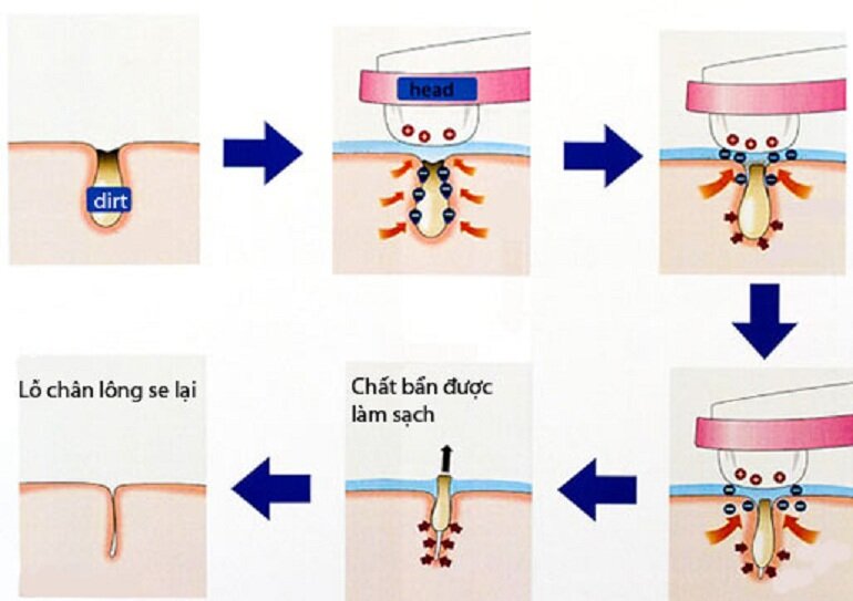 Công nghệ ion giúp làm sạch bụi bẩn và bã nhờn