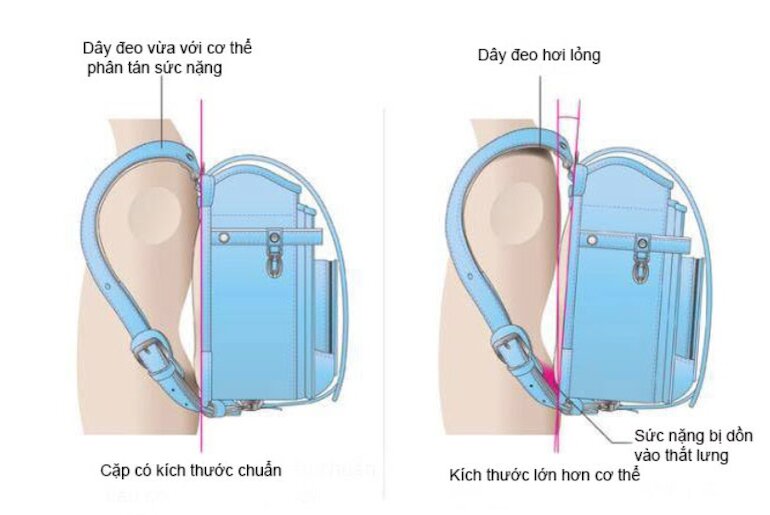 So sánh giữa kích thước cặp chuẩn và cặp không phù hợp