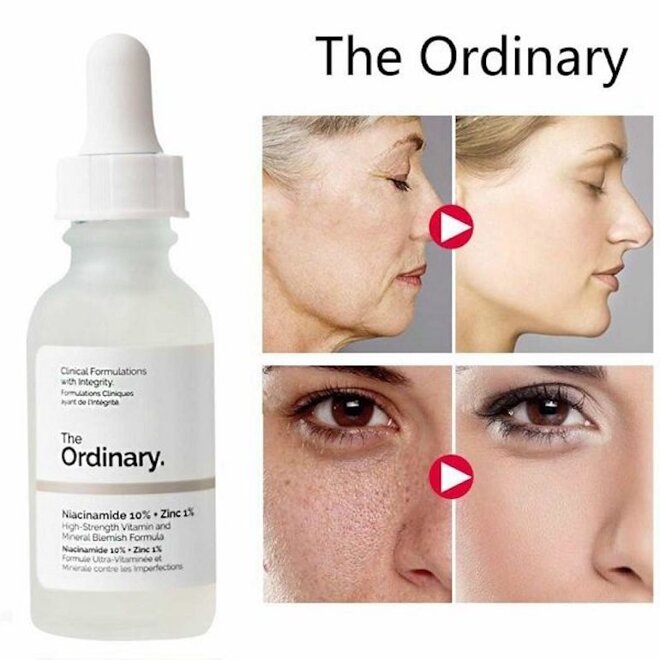 Review khi sử dụng Serum The Ordinary Niacinamide 10% + Zinc 1%