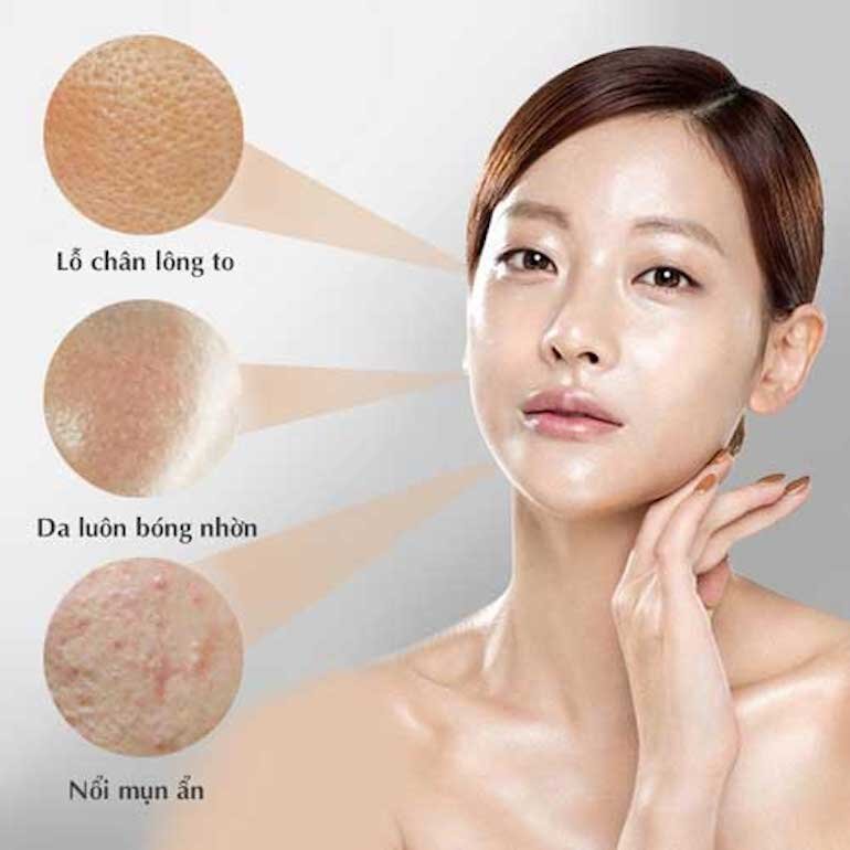 Da dầu/ nhờn nên sử dụng các loại mỹ phẩm có dạng gel hoặc dạng nước thẩm thấu nhanh