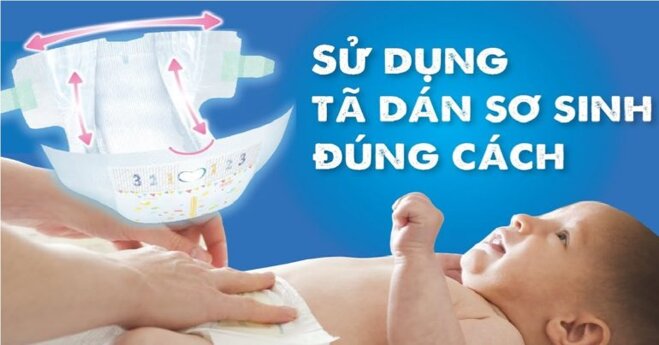 Cách sử dụng tã dán Bobby cho trẻ sơ sinh chuẩn khỏi chỉnh