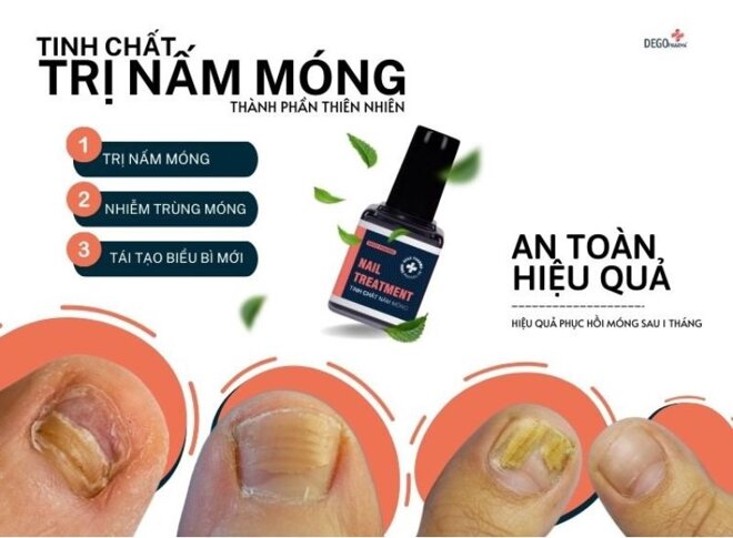 Review tinh chất nấm móng Dego Pharma Nail Treatment