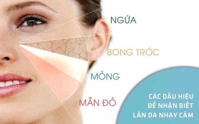 Da nhạy cảm thường mỏng, khô, dễ kích ứng nên cần có chế độ chăm sóc phù hợp.