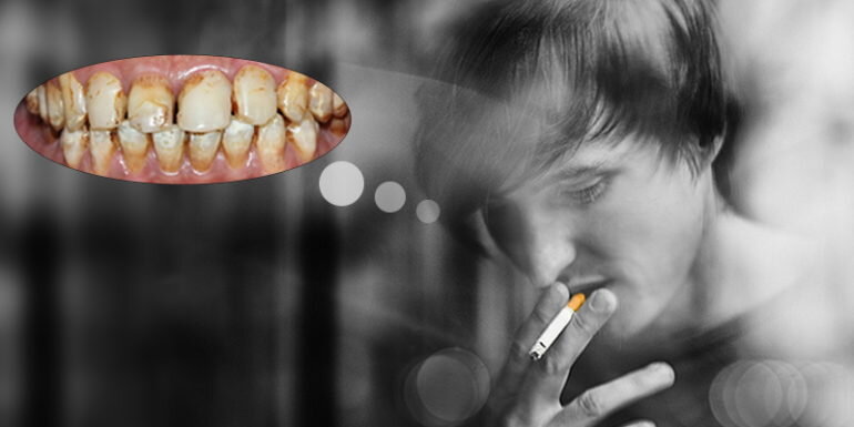 100% đàn ông hút thuốc răng đều vàng và có mùi hôi khó chịu ?