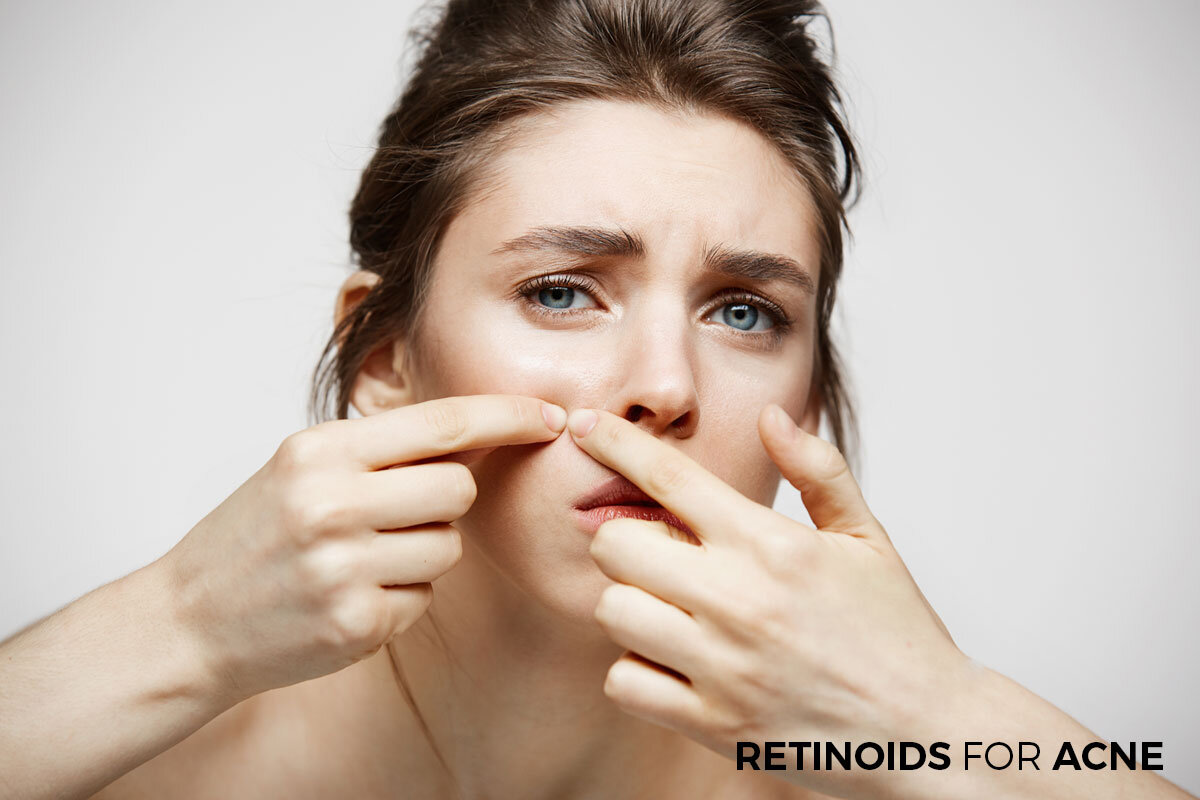 Retinoids mang lại tác dụng thần kỳ trong việc điều trị mụn