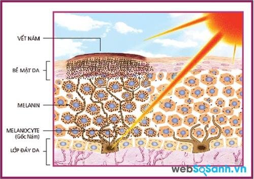 Hắc tố da (melanin) là hàng rào đầu tiên bảo vệ da khỏi tia UV