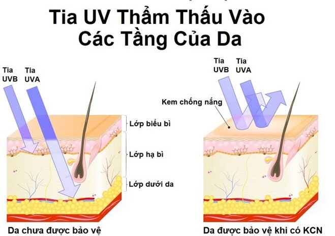 Tác dụng của kem chống nắng dành cho da mụn