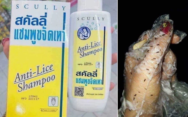 Dầu gội trị chấy Thái Lan Scully Anti Lice Shampoo