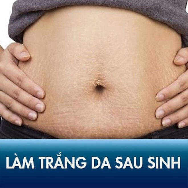 Làm trắng da sau sinh bằng sữa mẹ