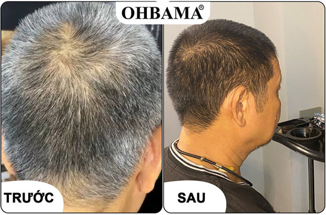 dầu gội nhuộm tóc ohbama