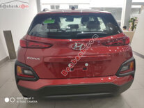 Xe Hyundai Kona 2.0 ATH 2022 - 665 Triệu