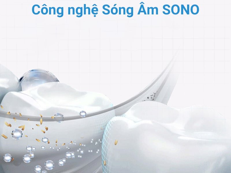 Công nghệ sóng âm làm sạch hiệu quả mảng bám