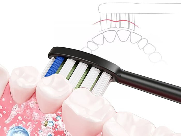 Bàn chải điện Magic B-25