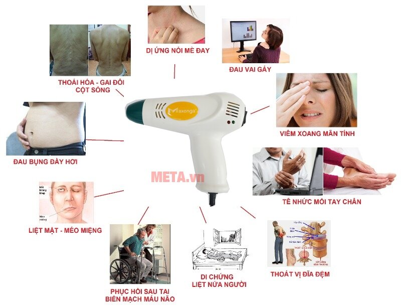 Máy xông cứu ngải Maxonga