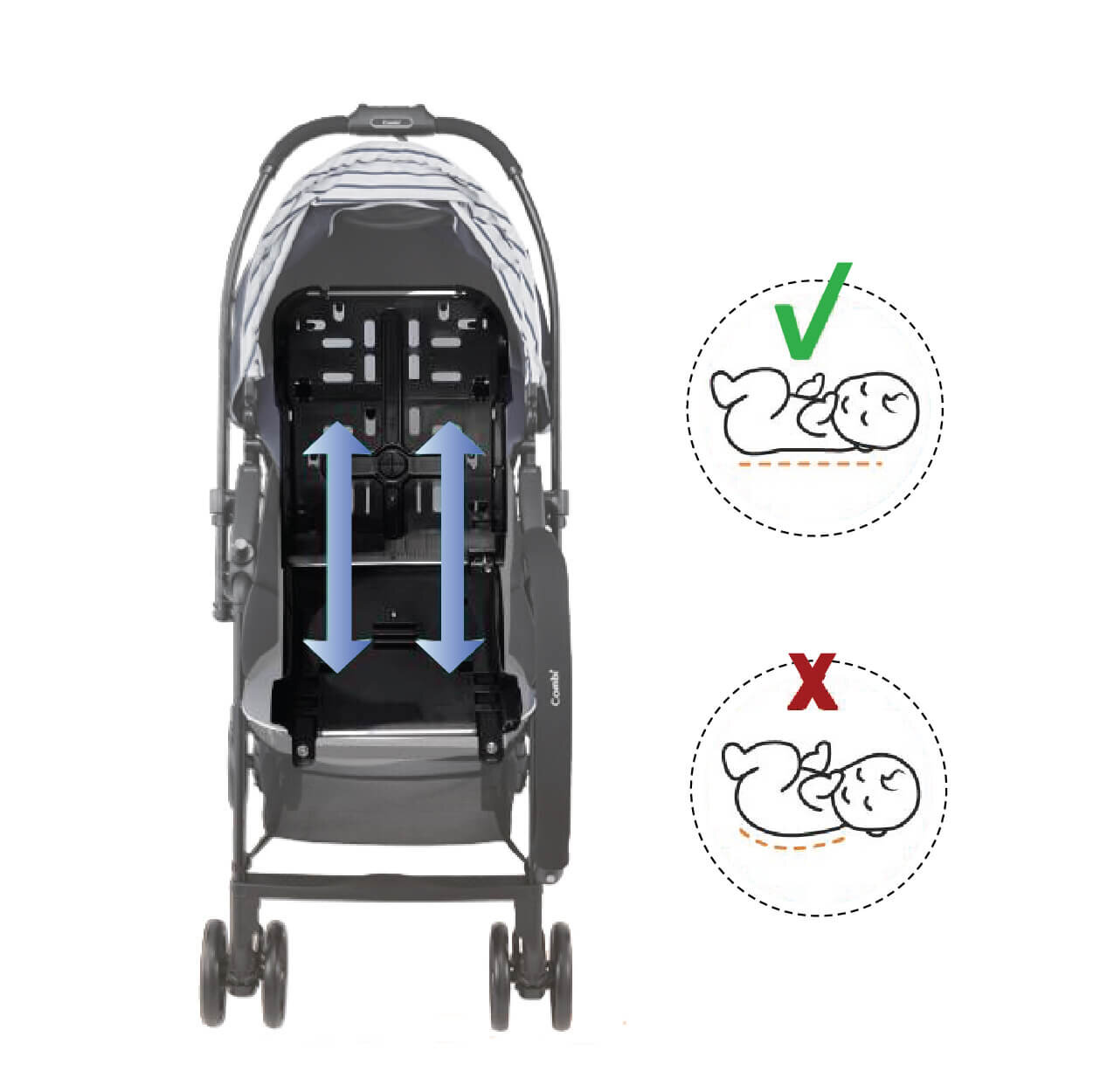 Lưng ghế chống gù ở xe đẩy Combi Neyo Plus Air