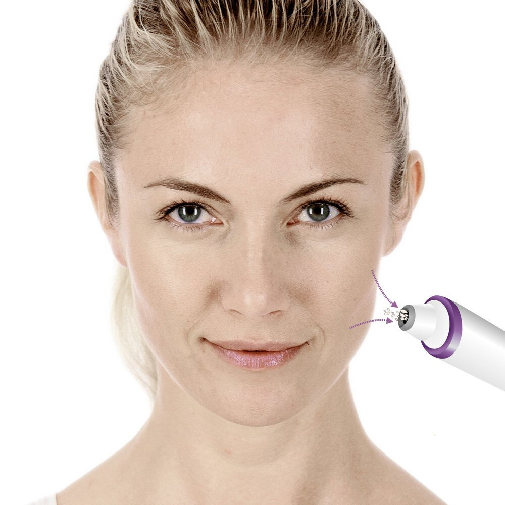 Máy hút mụn và tẩy tế bào chết Beurer FC76