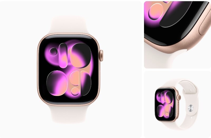 Đồng hồ thông minh Apple Watch Series 11 Nhôm 42mm GPS Sport Band