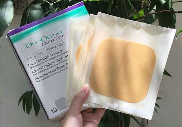 Is Duoderm acne patch effective? Should I buy it for use?