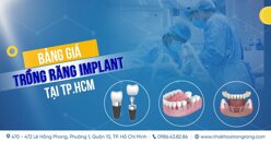 Bảng giá trồng răng Implant tại TP.HCM mới nhất hiện nay