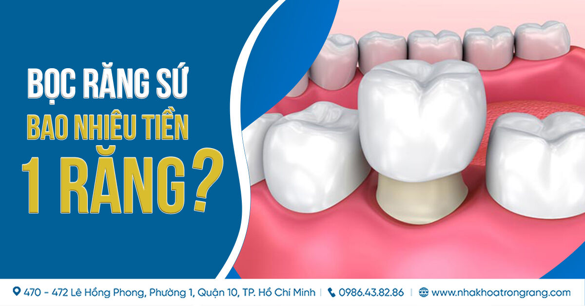 Bọc răng sứ giá bao nhiêu 1 răng? Bảng giá bọc răng sứ tại TP. HCM