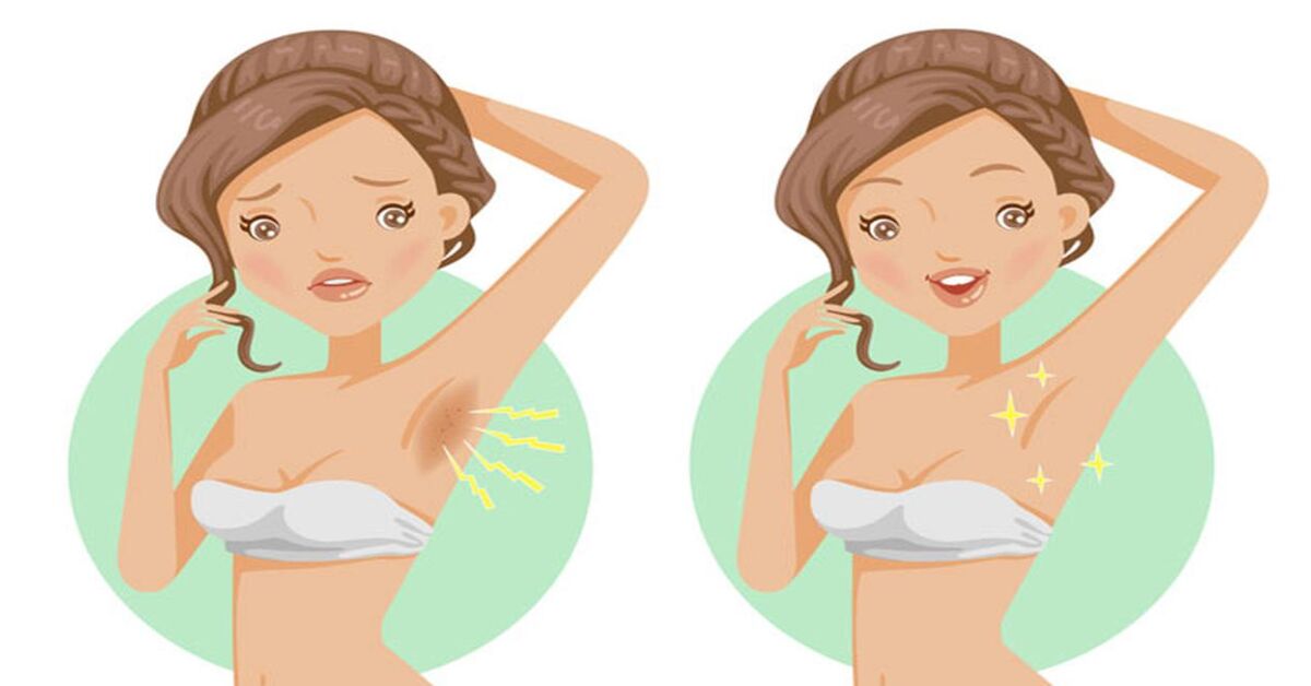 Cách trị thâm háng, bẹn, nách ở người lớn hiệu quả tự nhiên