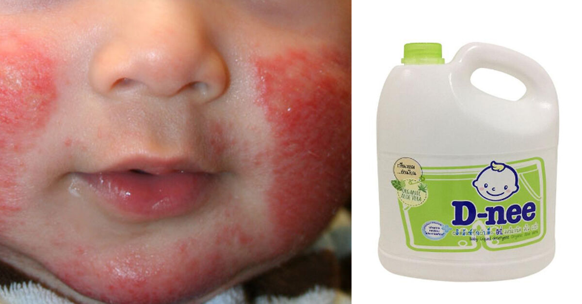 Có nước giặt dnee giả không ? Hậu quả khi dùng nước giặt dnee giả ?