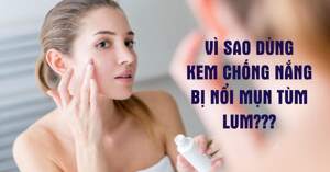 Giải đáp vì sao dùng kem chống nắng bị nổi mụn?