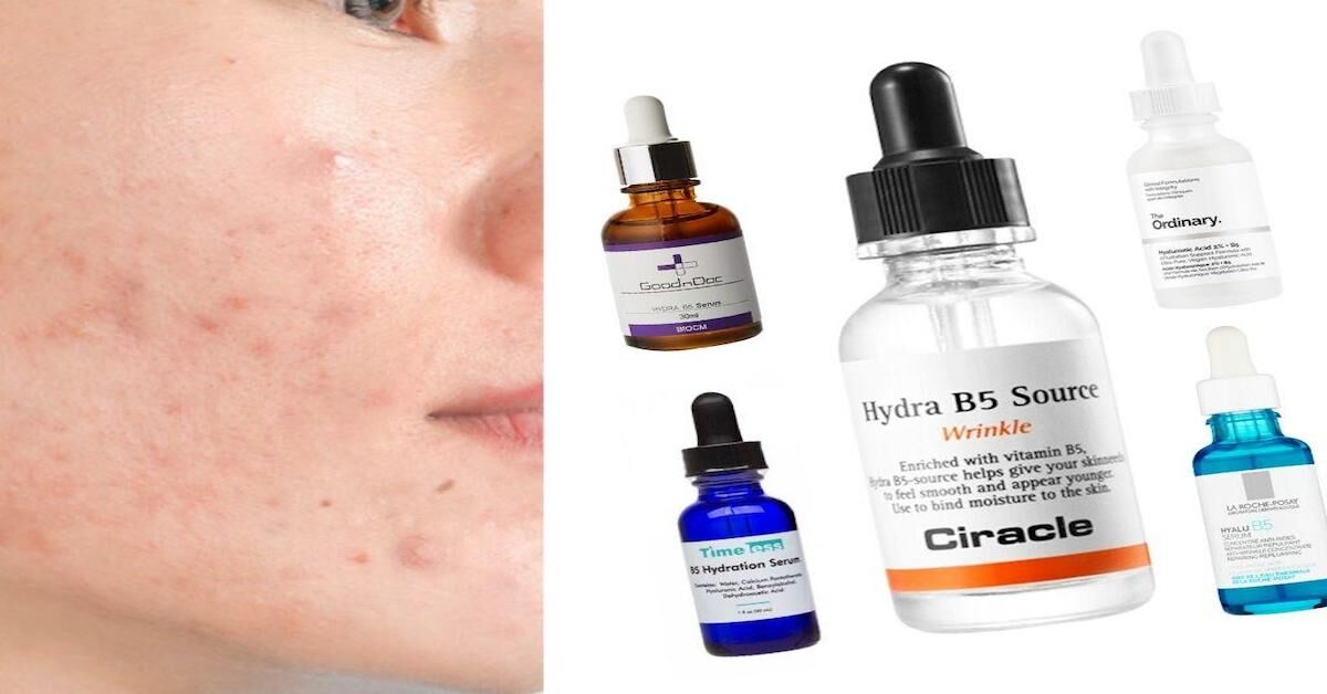 Gợi ý 4 serum phục hồi da mang lại hiệu quả cho da mụn, da nhạy cảm