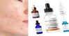 Gợi ý 4 serum phục hồi da mang lại hiệu quả cho da mụn, da nhạy cảm