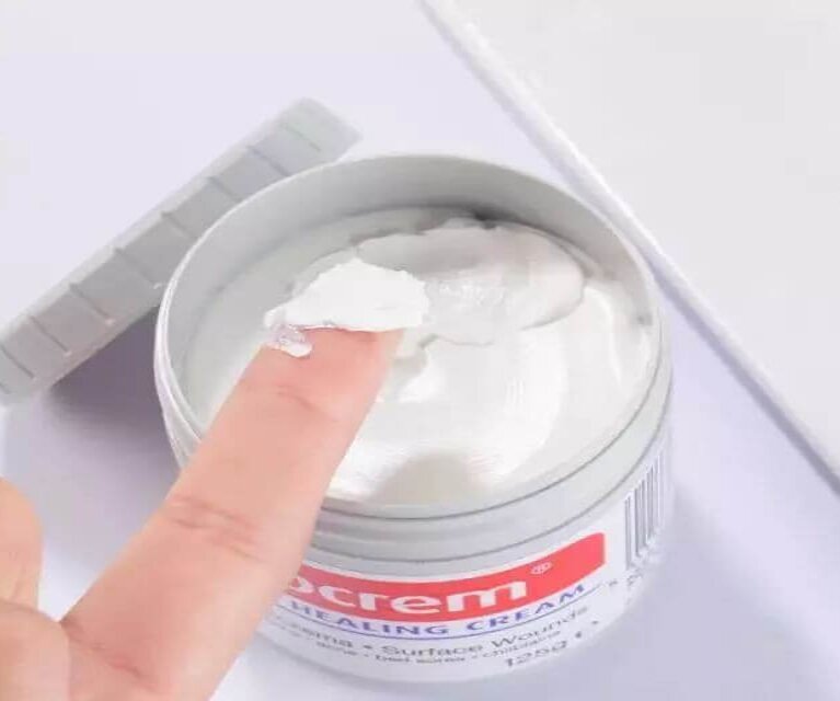 Kem chống hăm Sudocrem