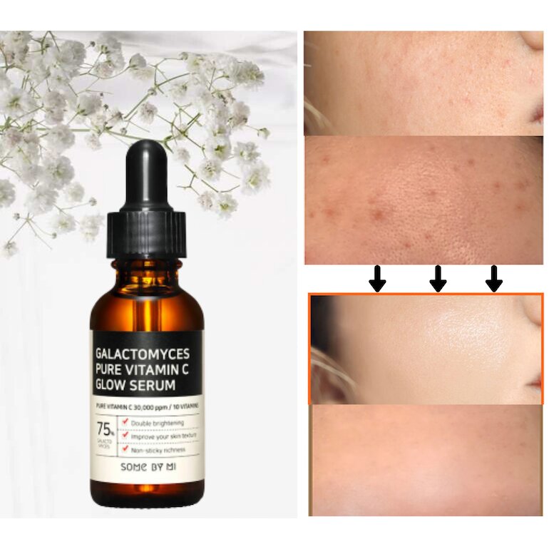 Serum Some by Mi Galactomyces Pure Glow