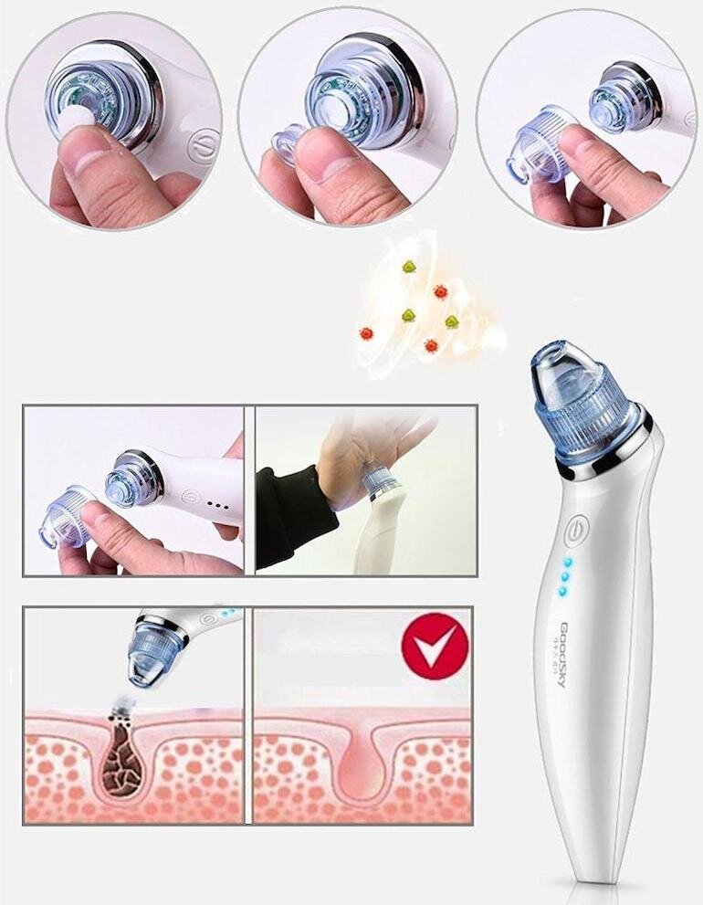 Máy hút mụn có những đầu nặn mụn với kích cỡ khác nhau