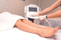 Máy triệt lông công nghệ IPL có ưu nhược điểm gì?
