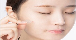 Nên lựa chọn miếng dán mụn nào tốt để sử dụng?