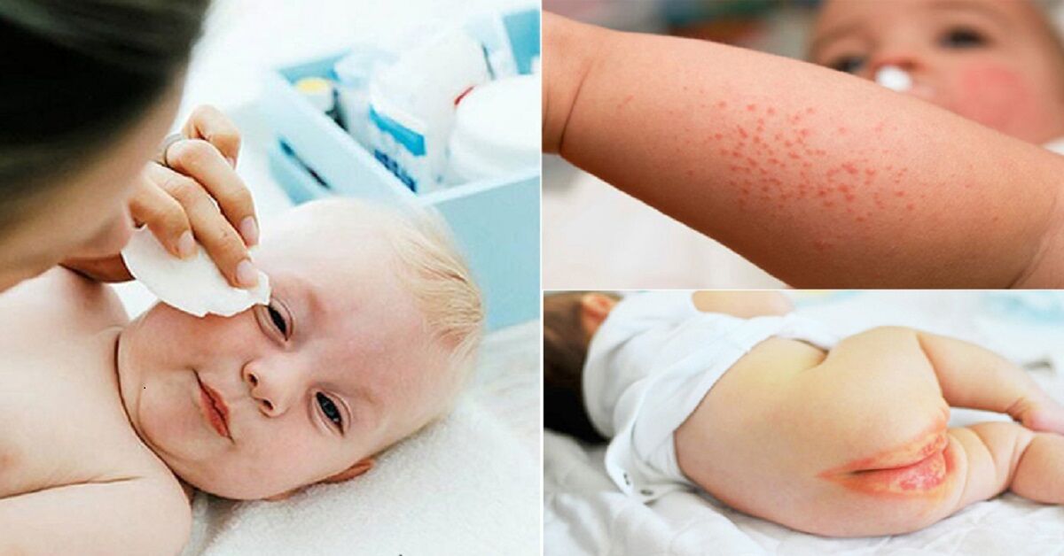 Những tác hại khôn lường của việc lạm dụng khăn ướt cho bé