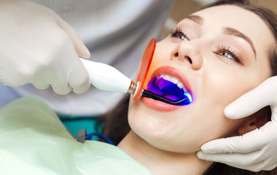 Review có nên tẩy trắng răng bằng đèn Plasma, ưu nhược điểm