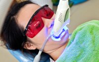 Review công nghệ tẩy trắng răng Bleachbright có ê buốt không, chi phí?