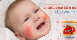 Review Similac Isomil Rumusan Khas là sữa gì? Có tốt không? Có dễ uống không?