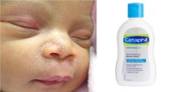 Sữa tắm Cetaphil đặc trị chàm cho bé là loại nào? Dùng được cho bé mấy tháng tuổi?