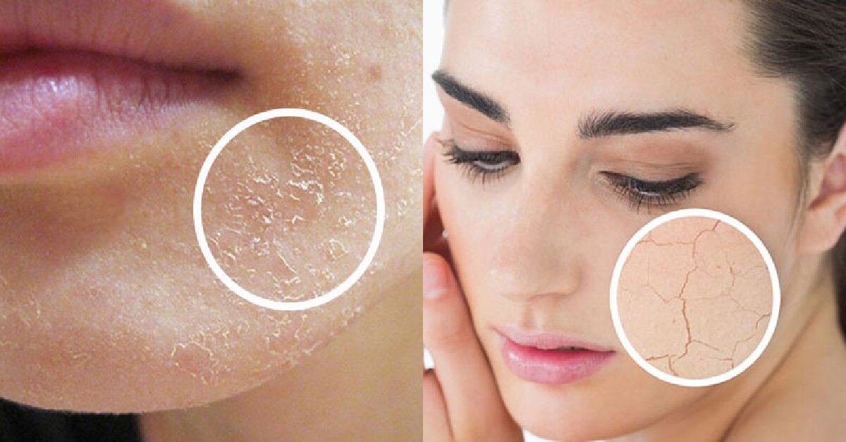Tổng hợp các loại sữa rửa mặt Hàn quốc dành cho da khô