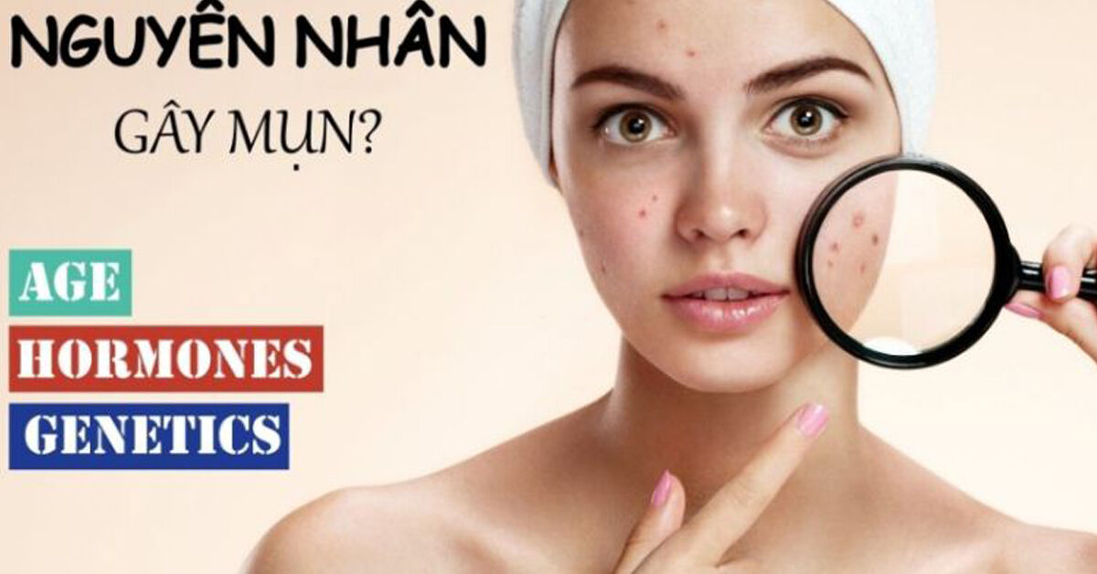 Top 3 sản phẩm trị mụn bình dân cho mơ ước làn da sạch mụn và sáng mịn của mọi cô gái thành sự thật